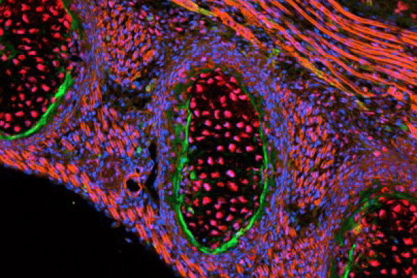 Mouse embryo section immunolabelled for developmental proteins