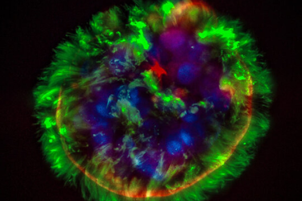 Spheroid composed of basal cells