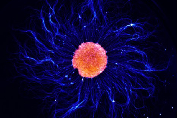 hiPSC-derived motor neurons